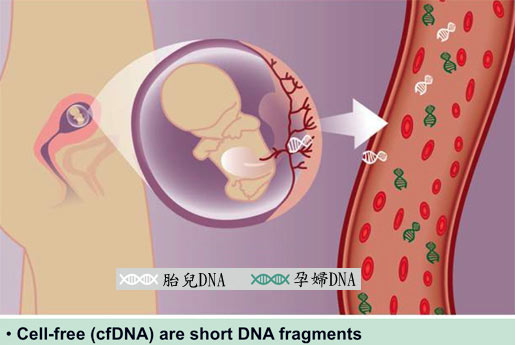 无创DNA产前检测(精准升级版)