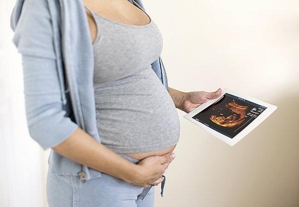 孕期可以进行香港无创DNA产前亲子鉴定吗？